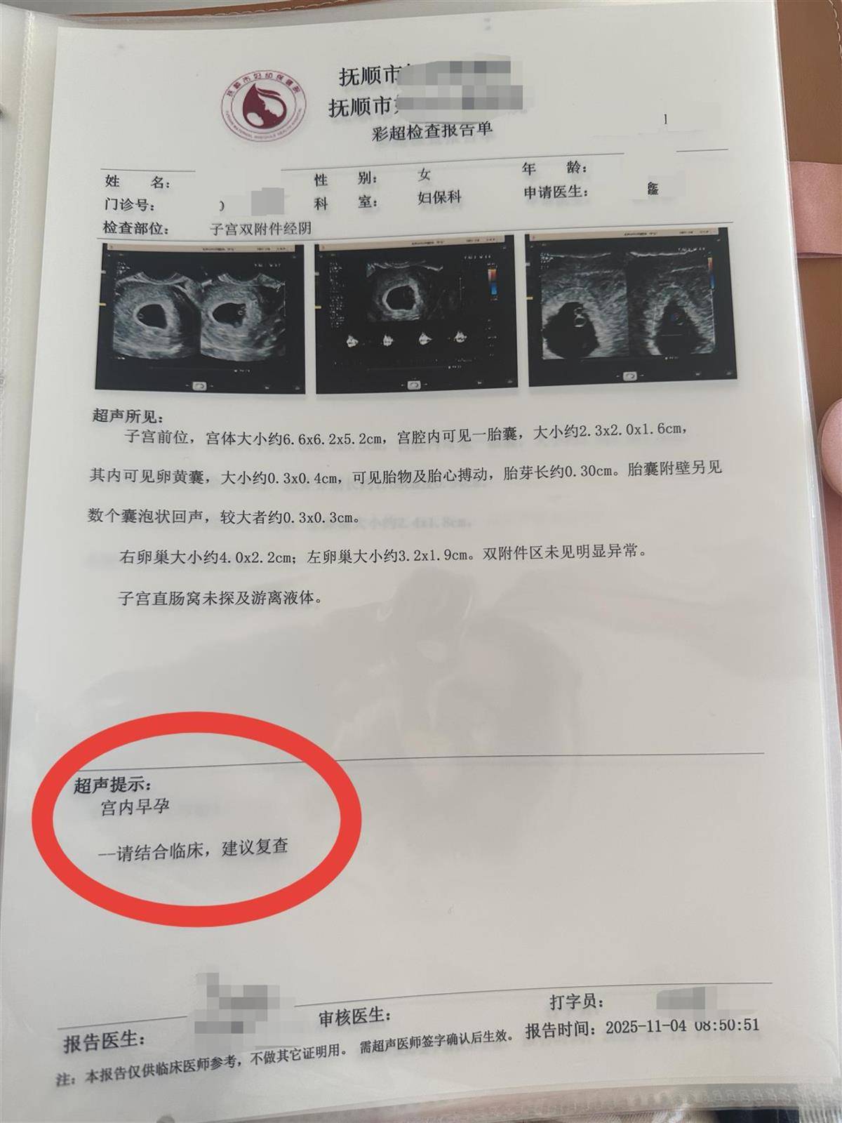 洛斯查兰特vs域堡
_辽宁一孕妇两个月内从一胎变四胞胎洛斯查兰特vs域堡
,每次产检发现多出一胎,医生:系同卵四胞胎,概率1300万至1500万分之一